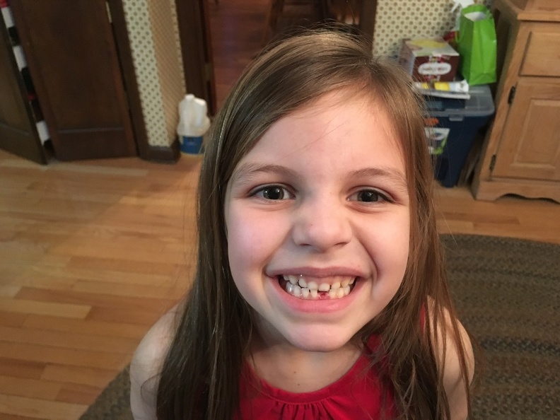 Greta first missing tooth.jpeg